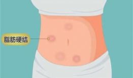 胰岛素注射方法视频,视频教程助您轻松掌握